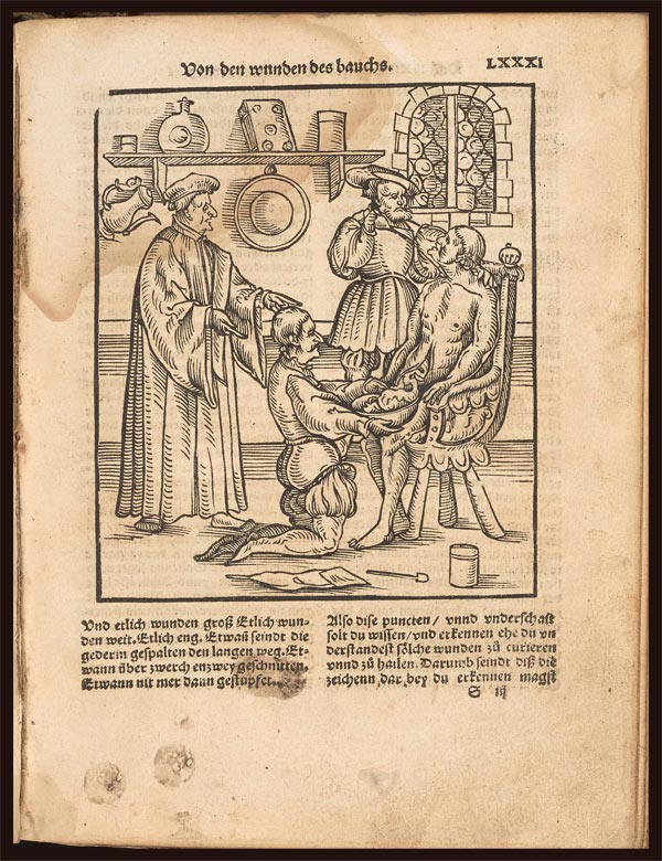 Hieronymus Brunschwig